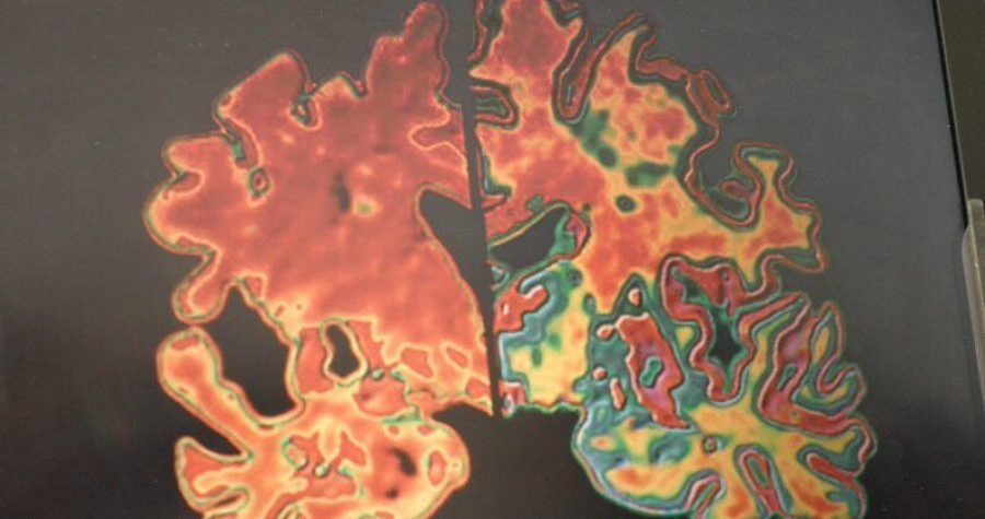 Možemo li se riješiti “zločestih” gena?